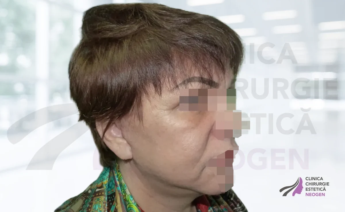 После