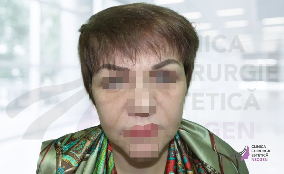 После