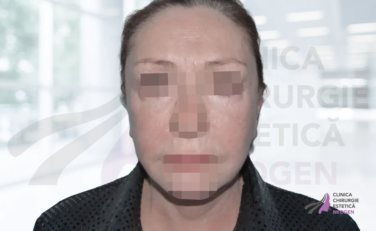 После