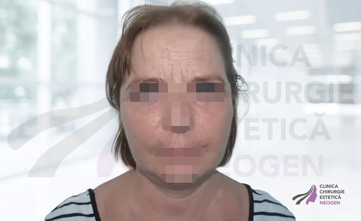 После