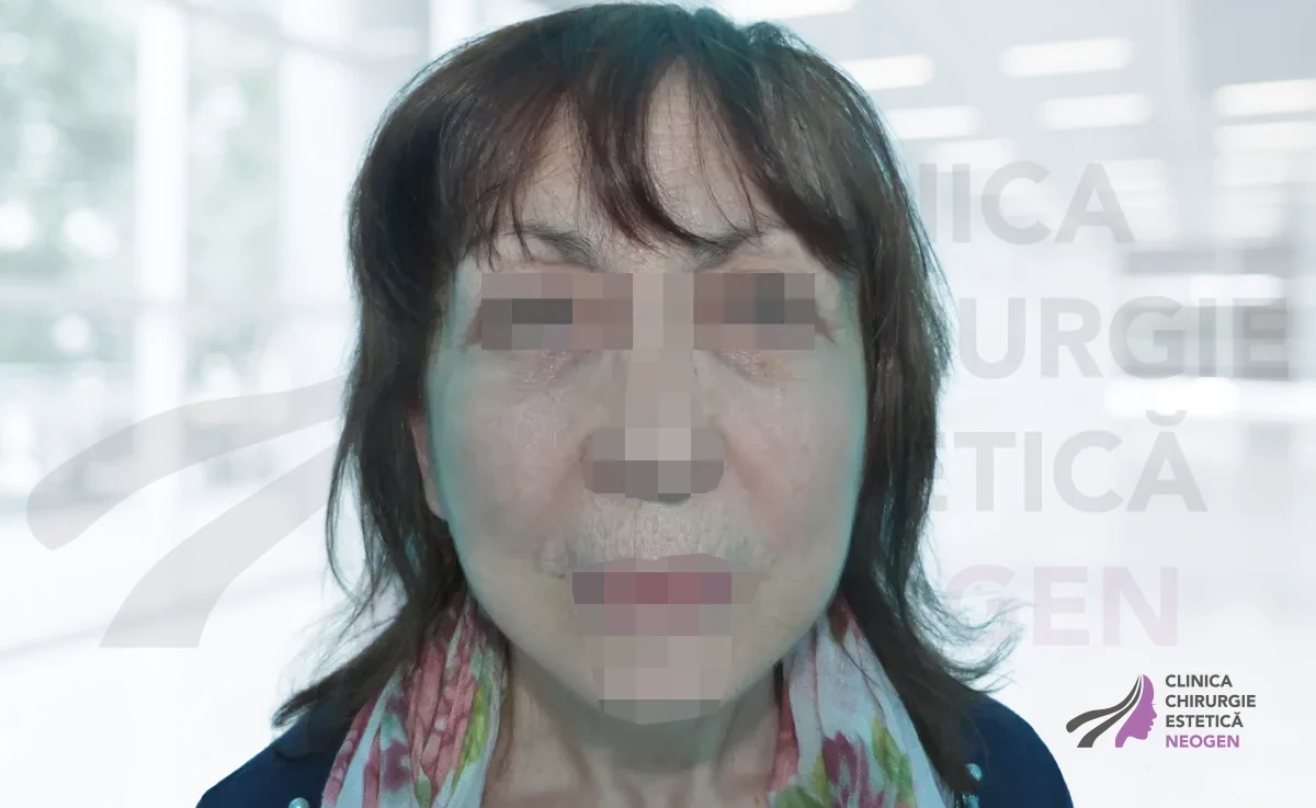 После