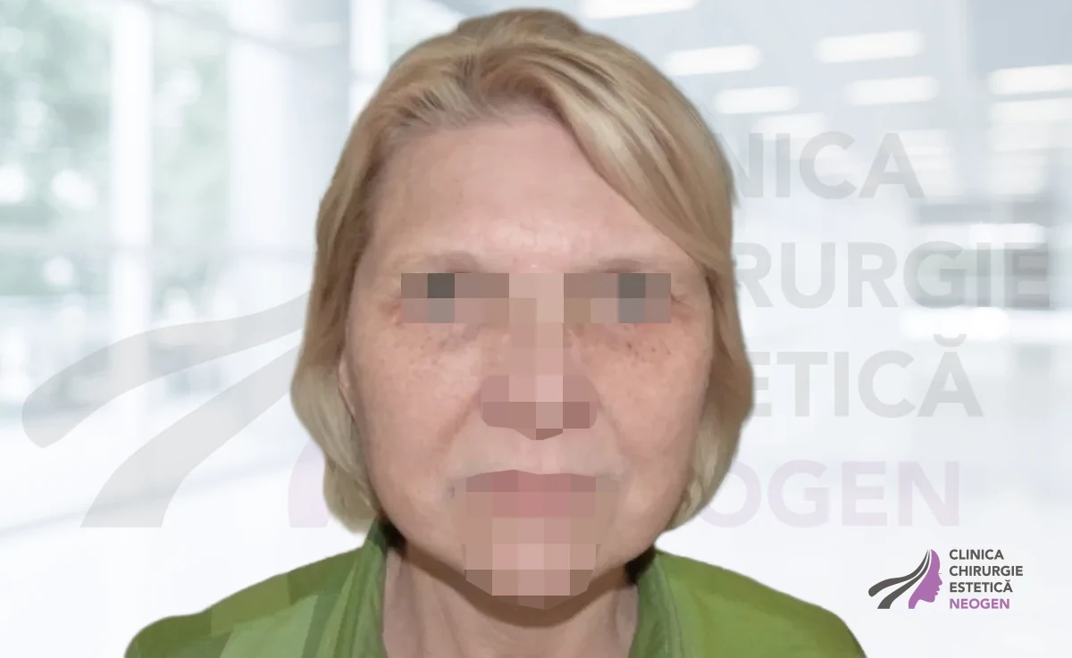 После
