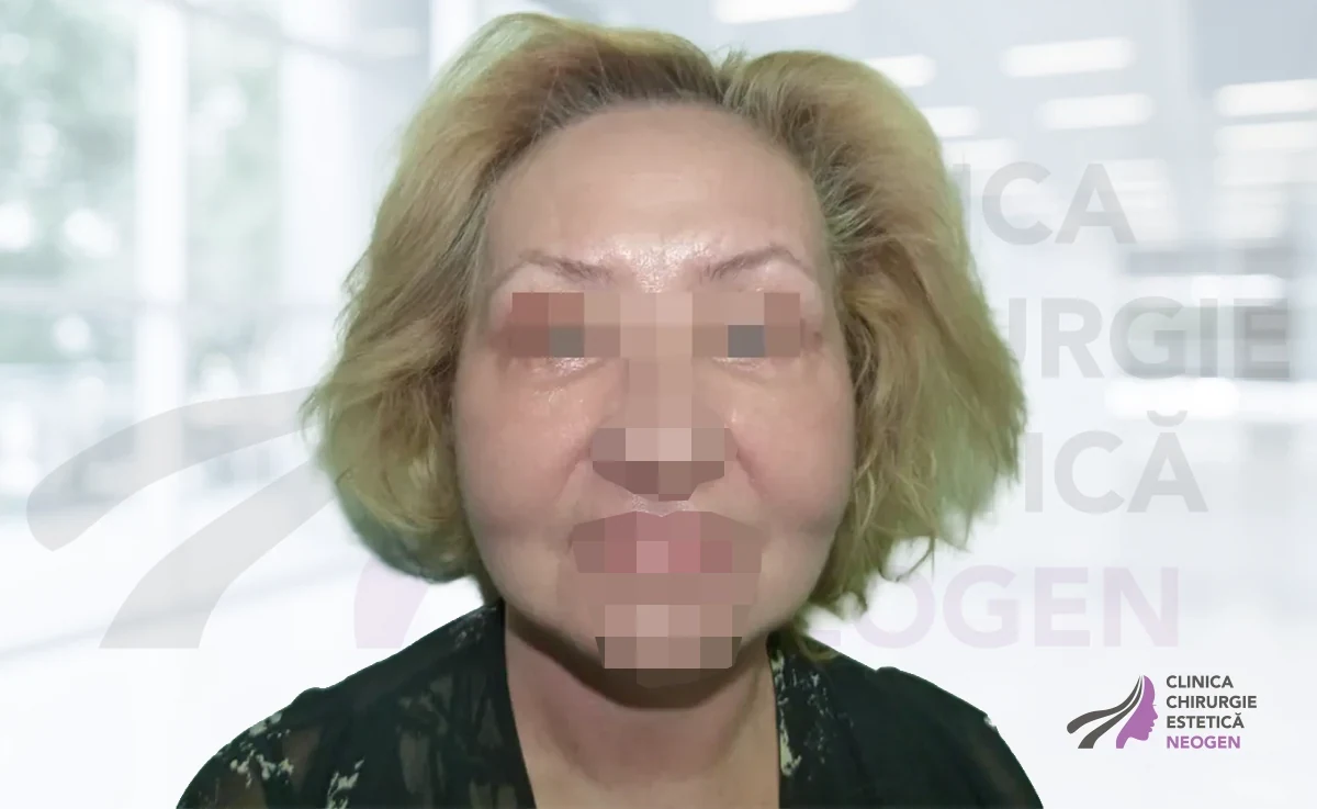 После