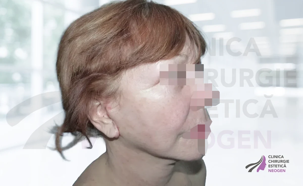 После