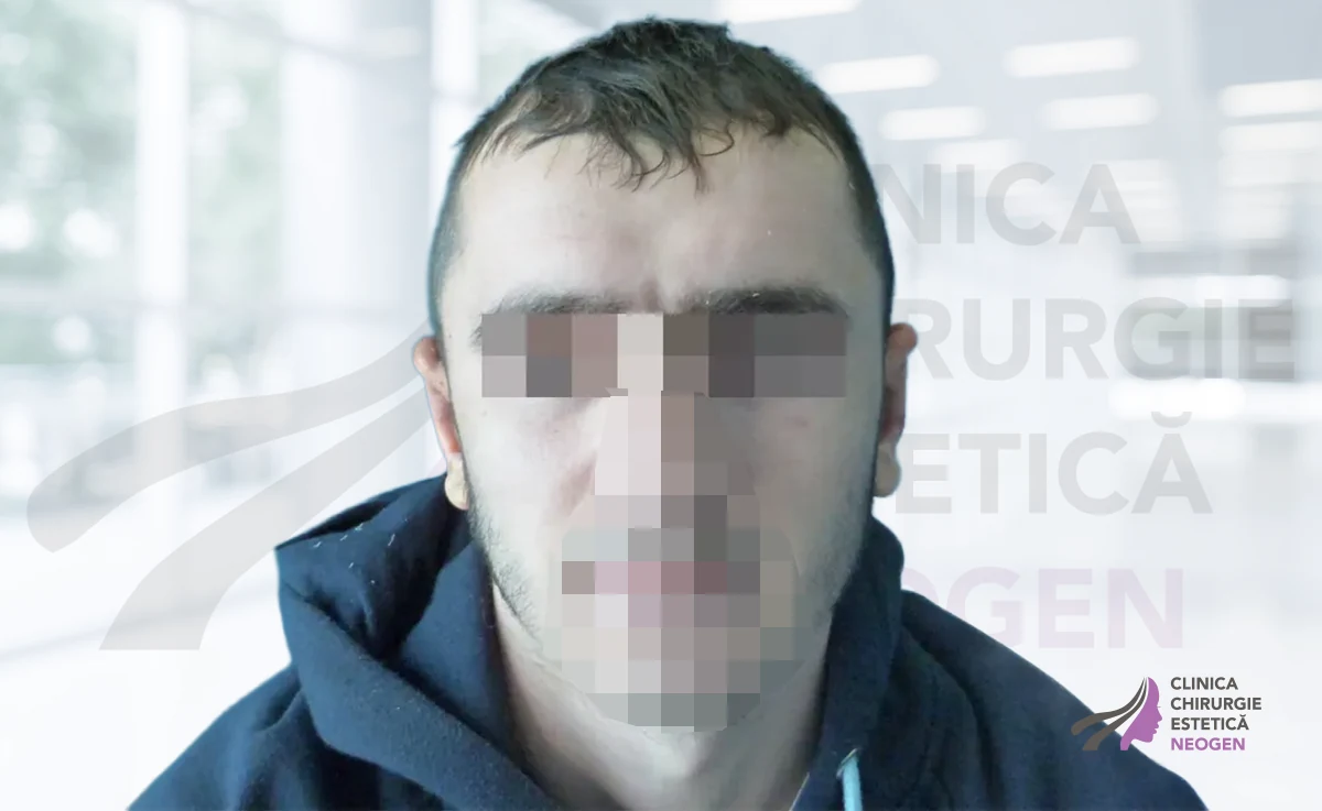 După