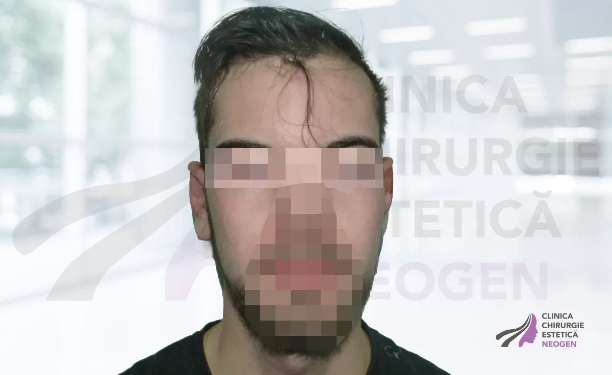 După
