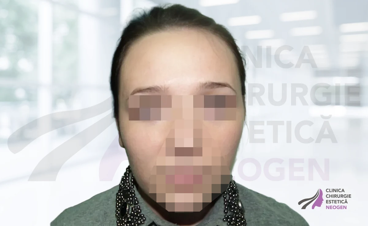 După