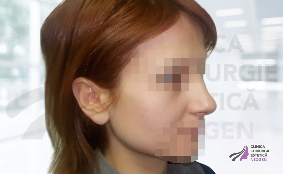 После