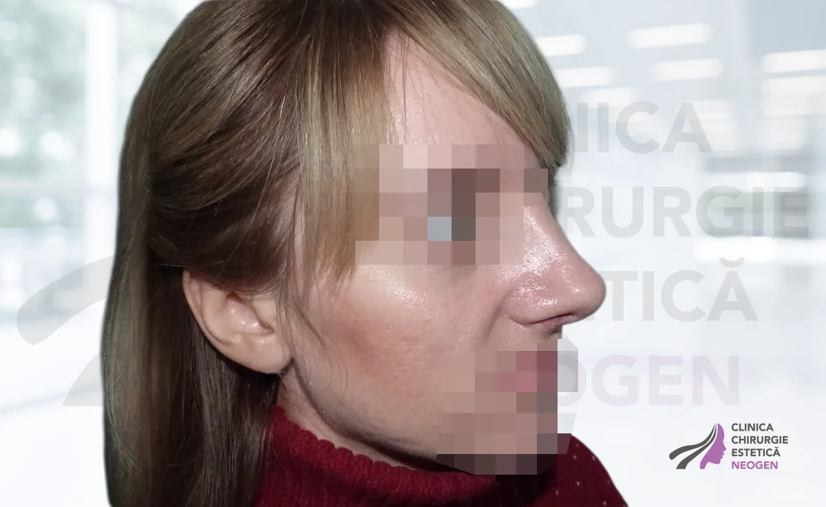 После