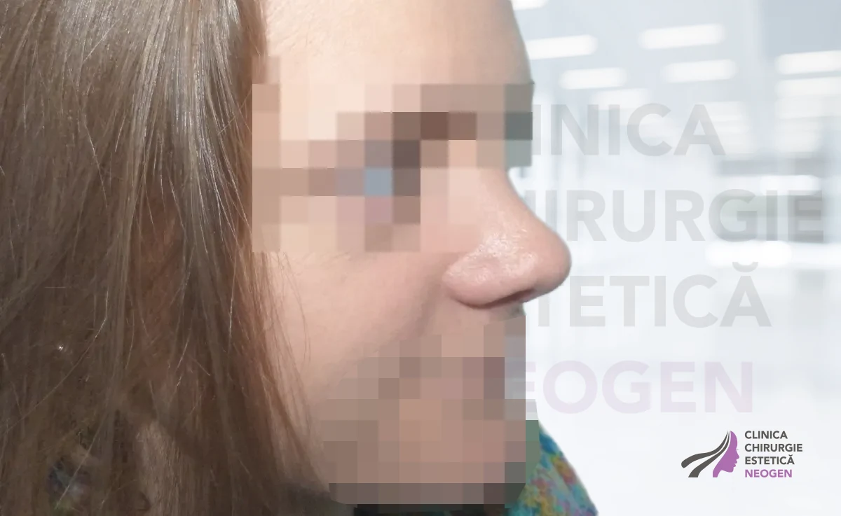 После