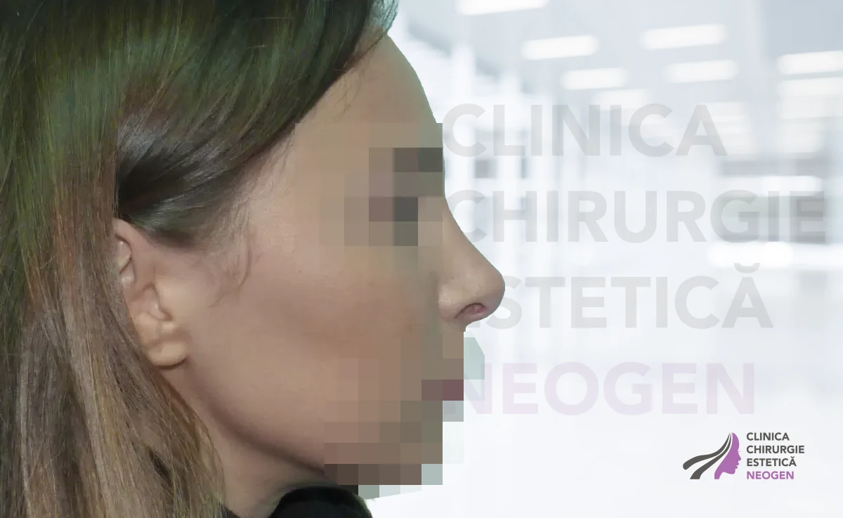 После