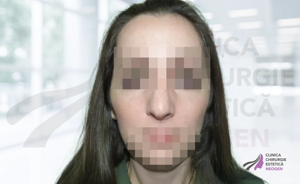 После