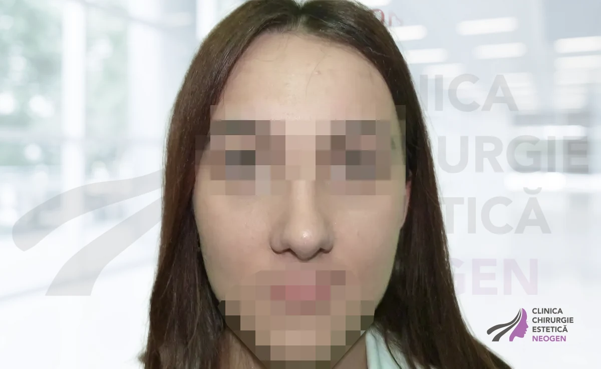 После