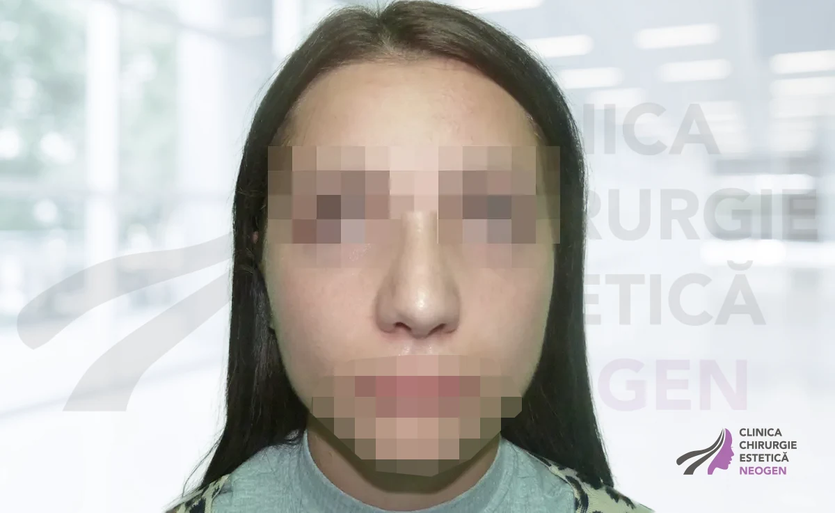 После
