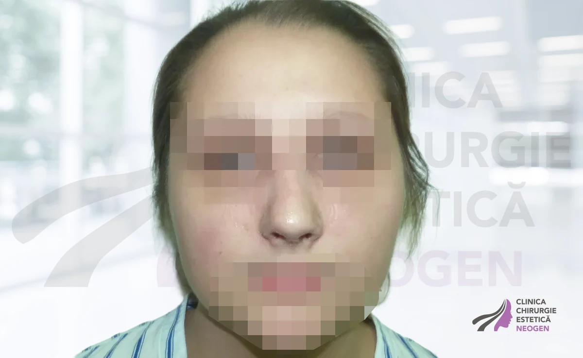 После