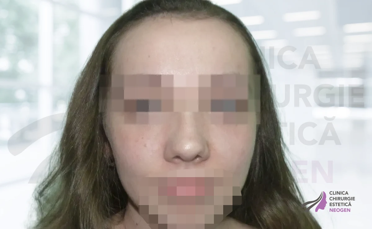 После