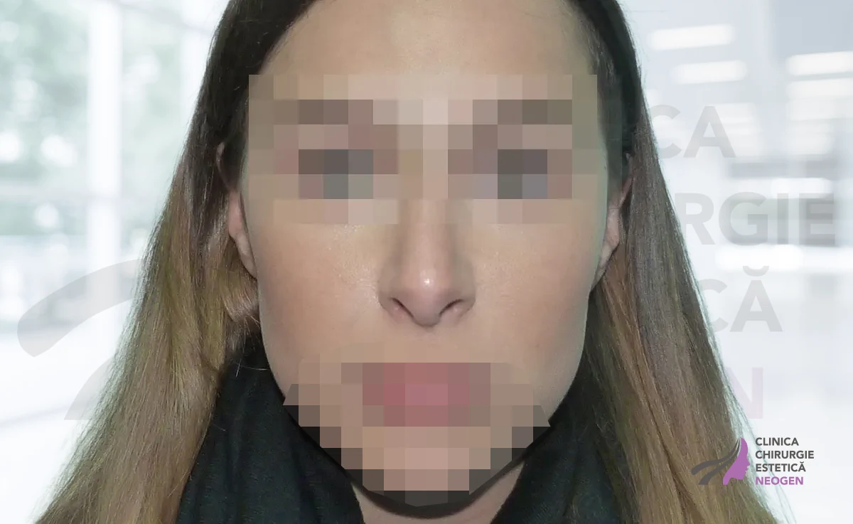 После