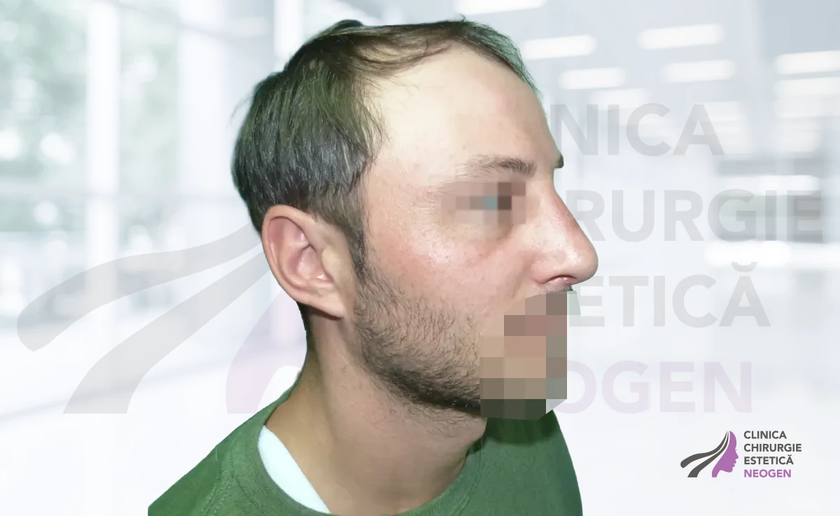 После