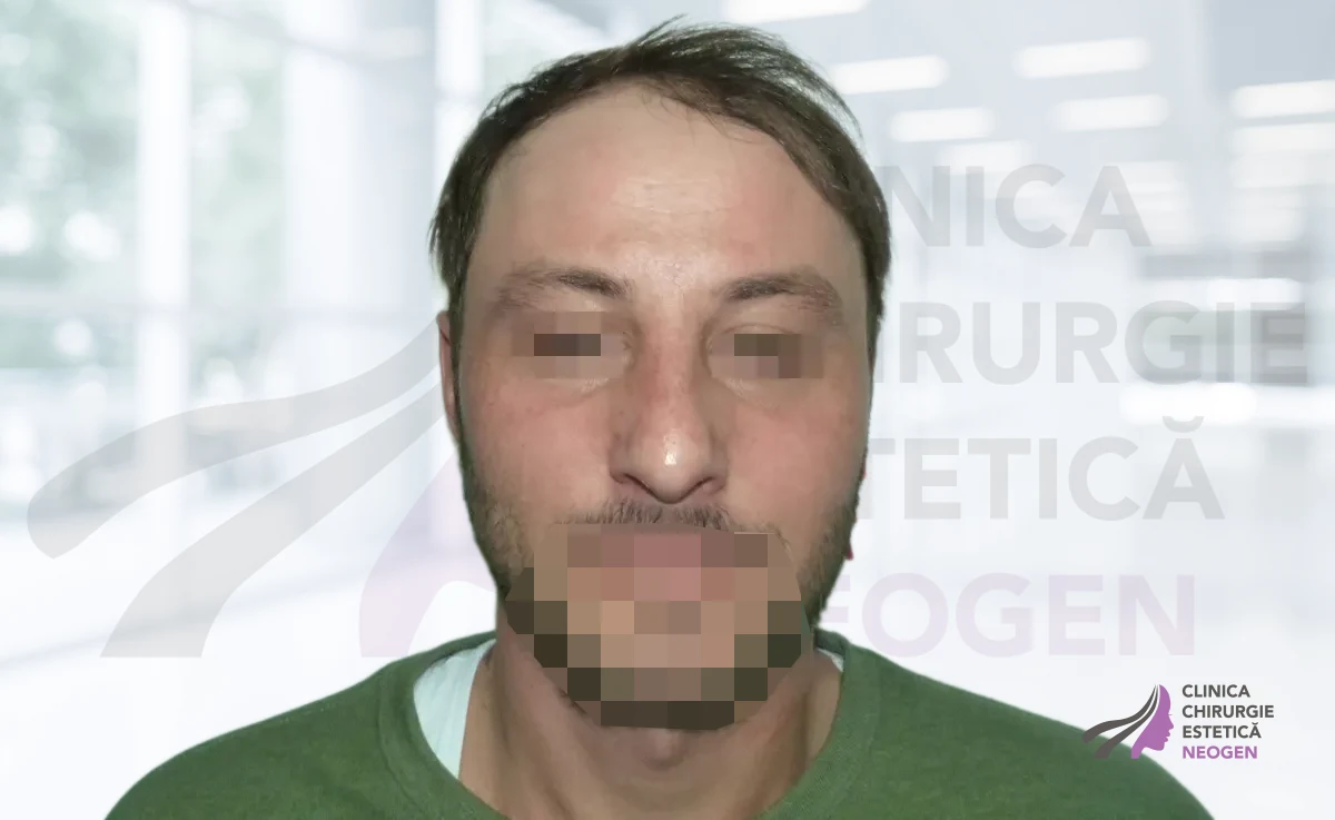 После