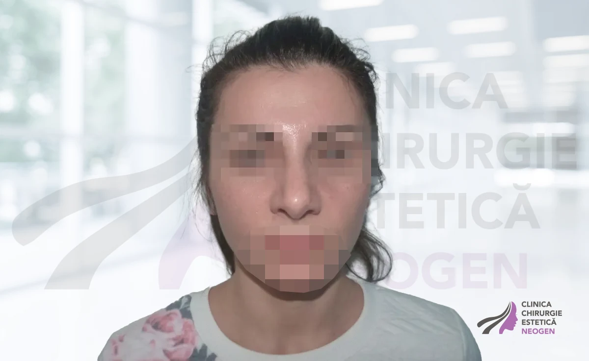 После