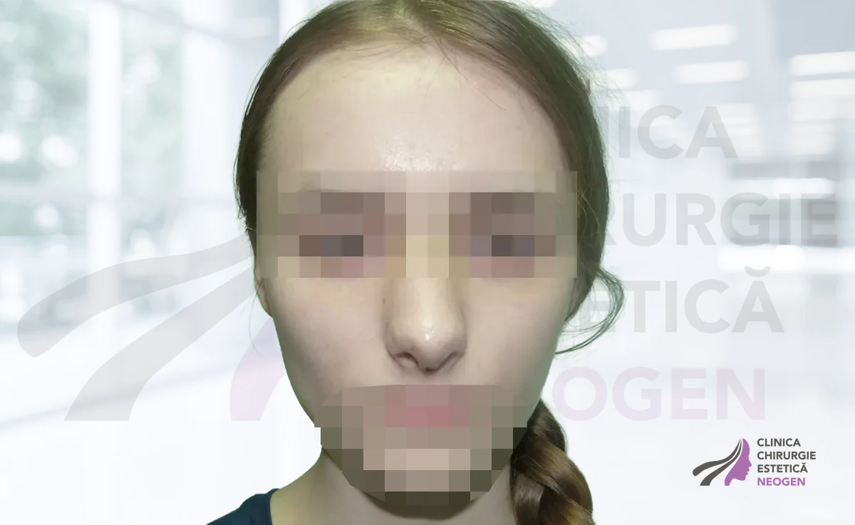 После