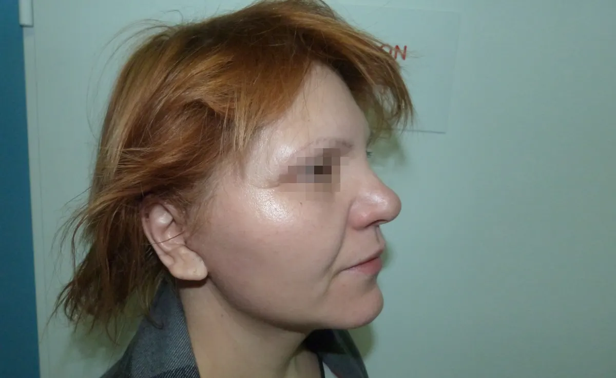 După