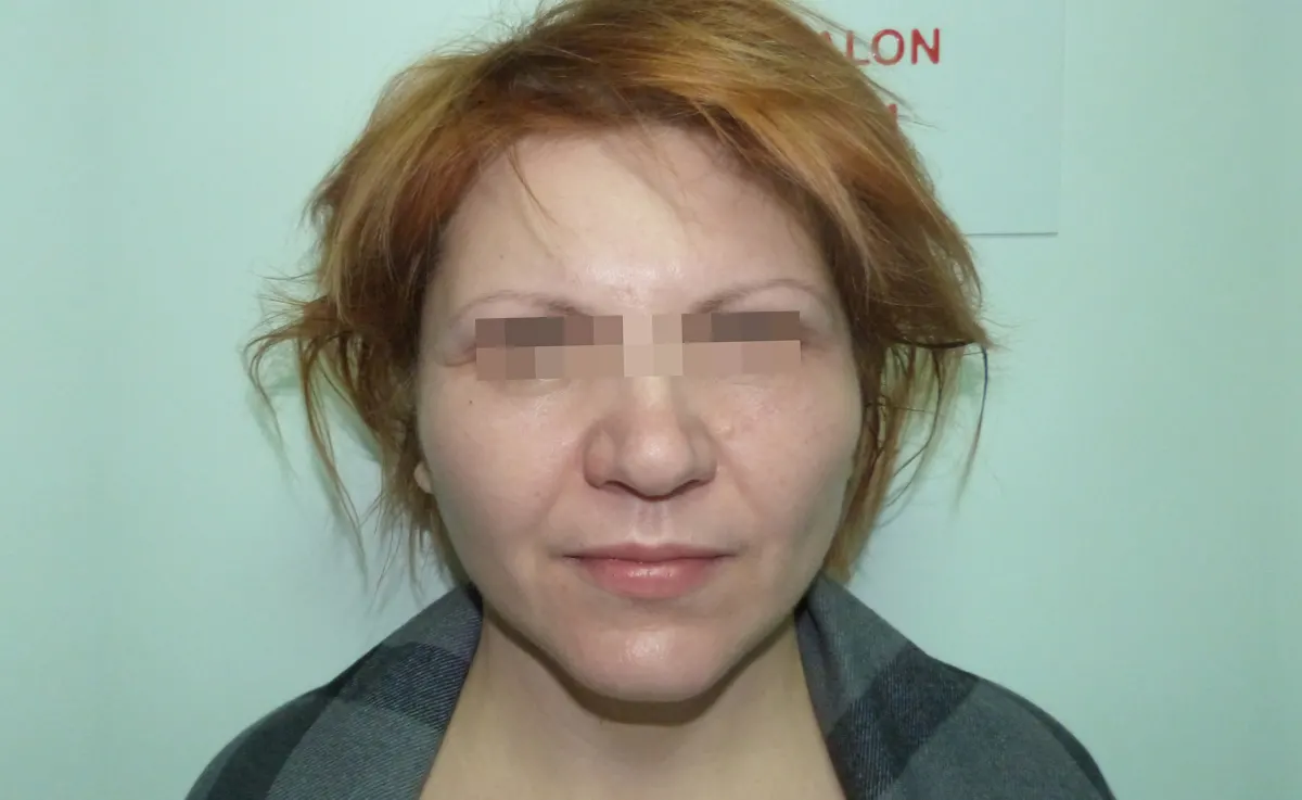 După