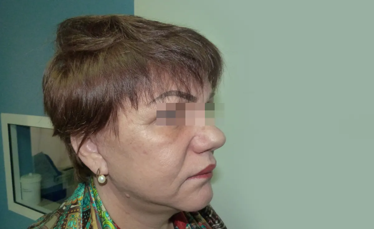 După