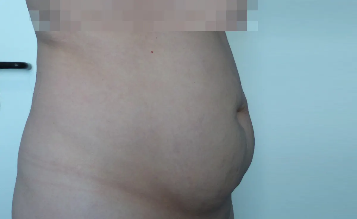 Before