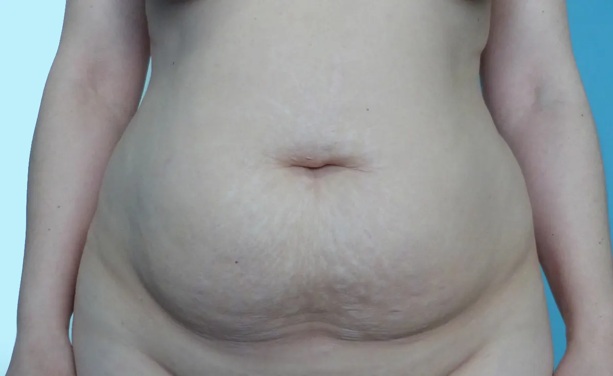 Before