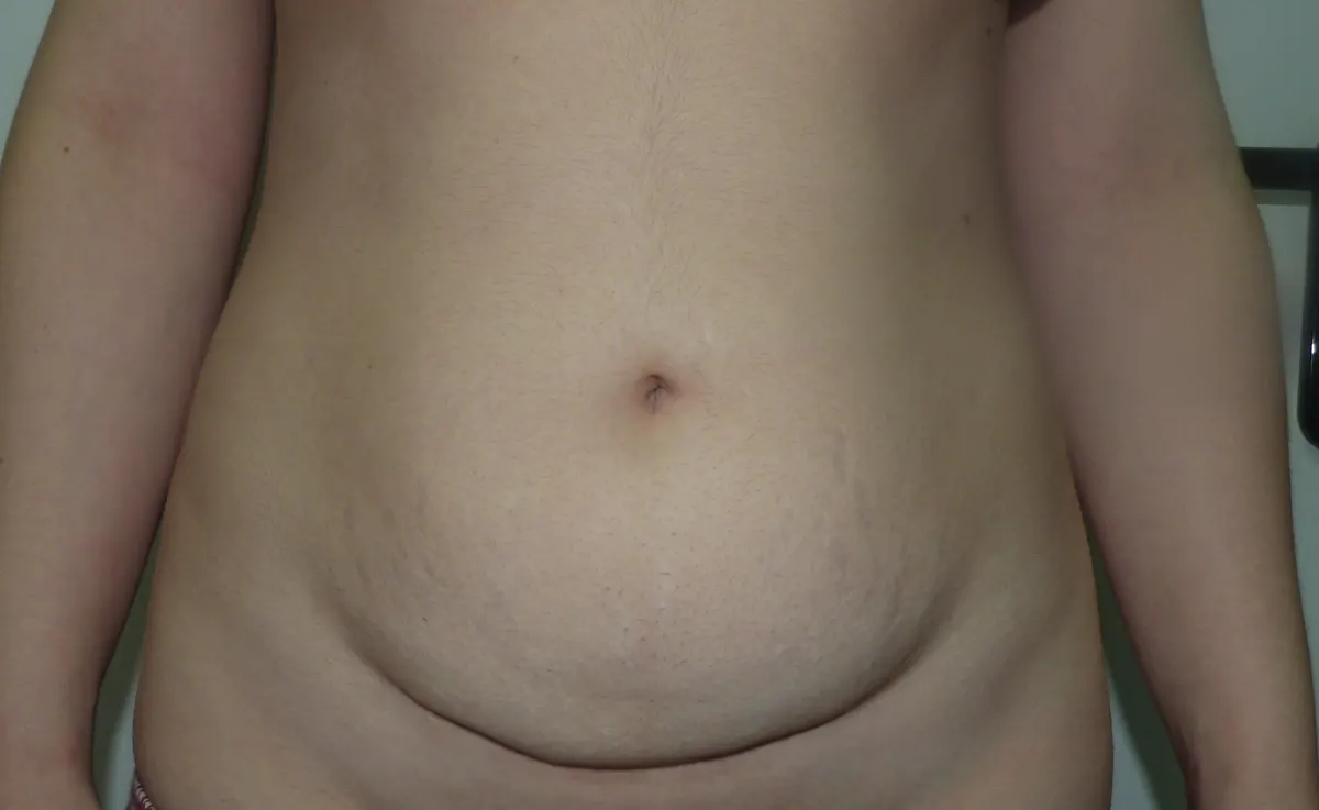 Before