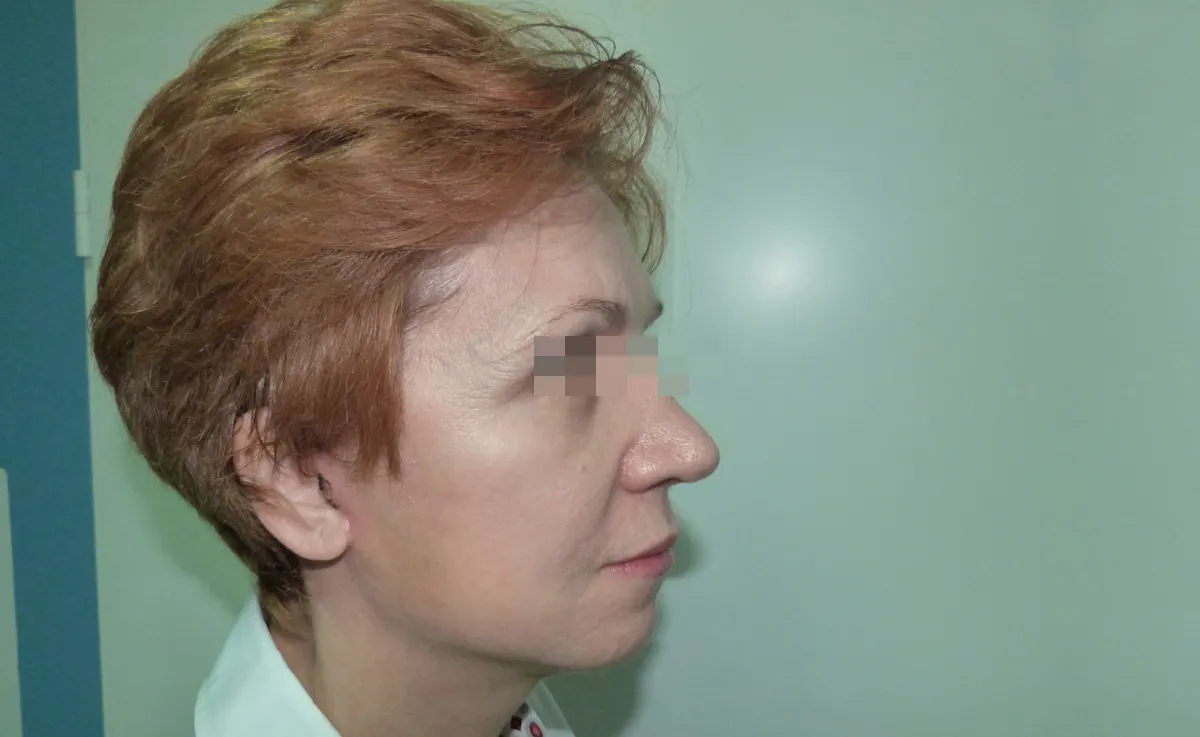 După