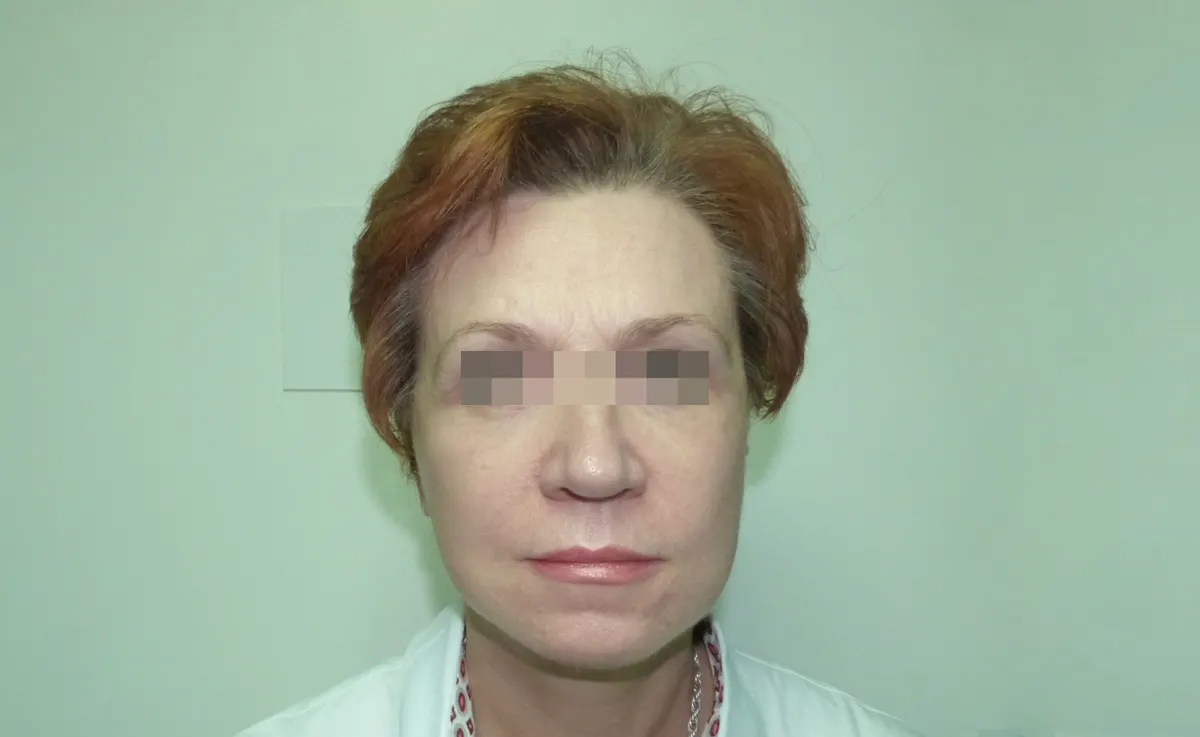 După