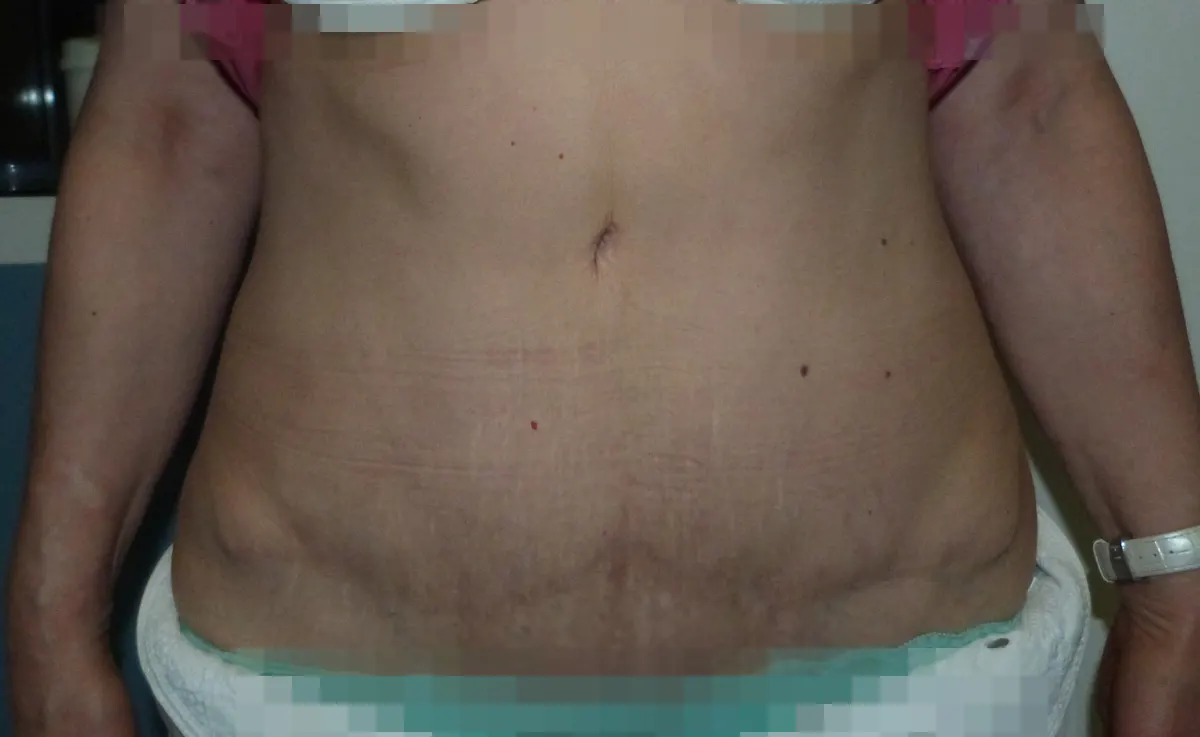 After