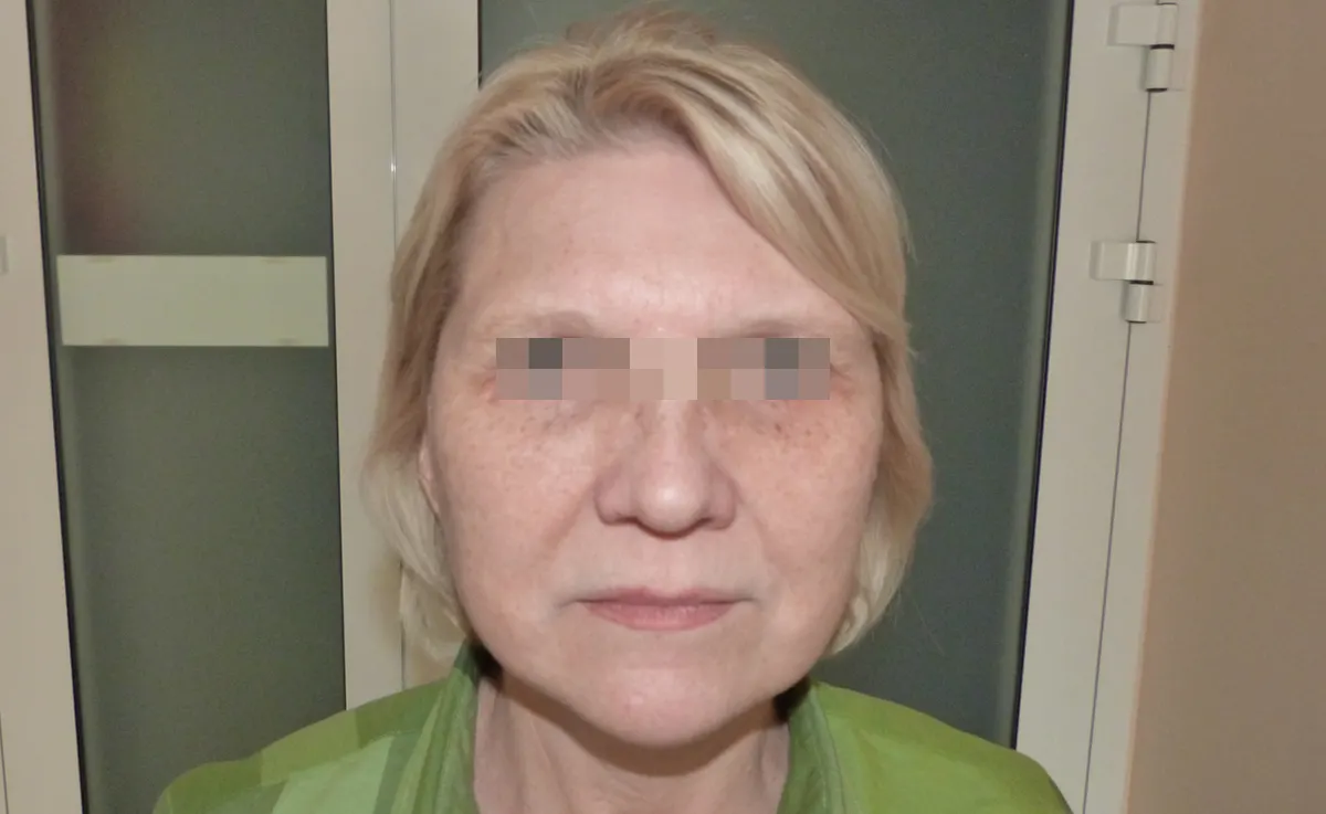După