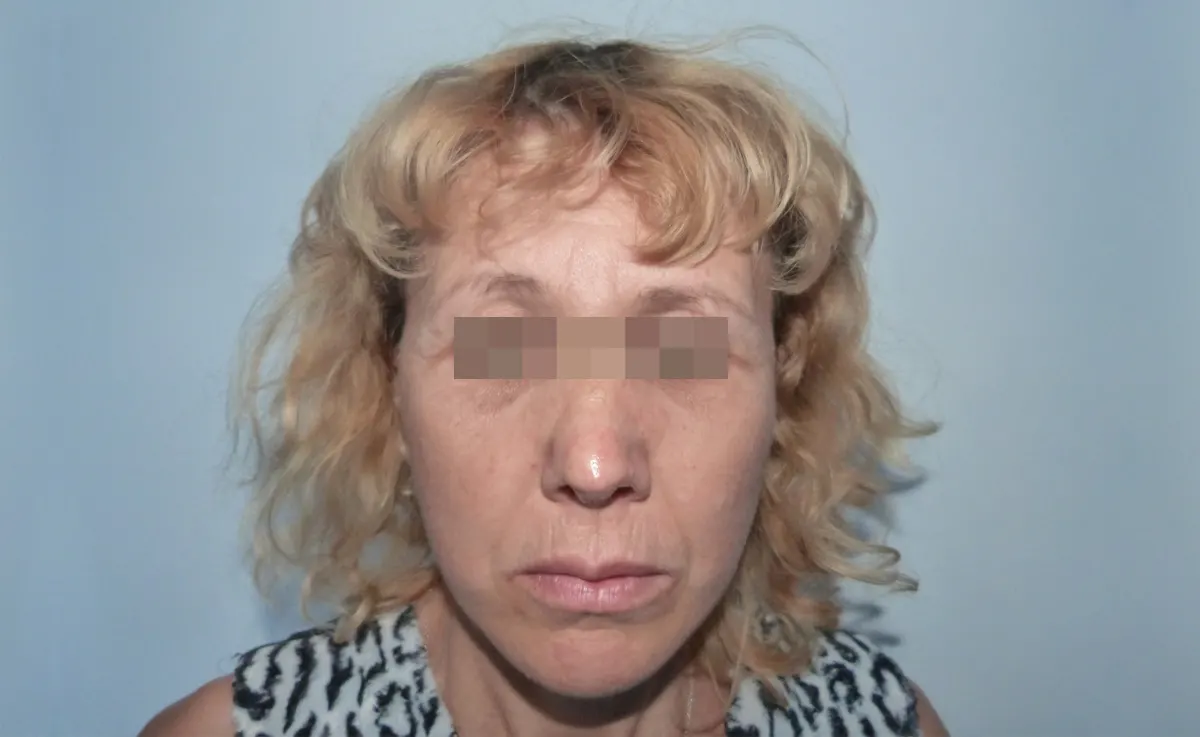 După