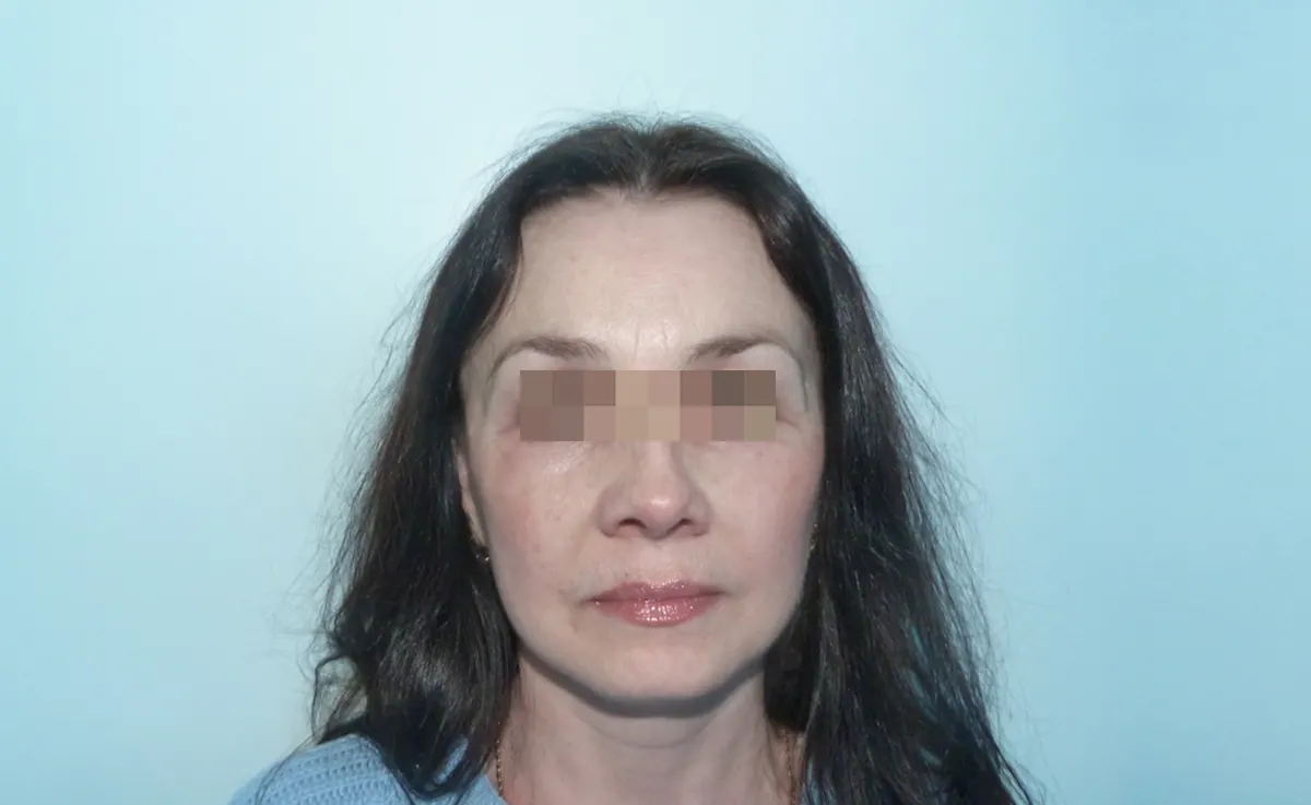 După