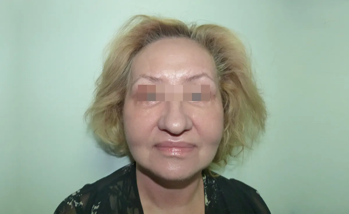 După