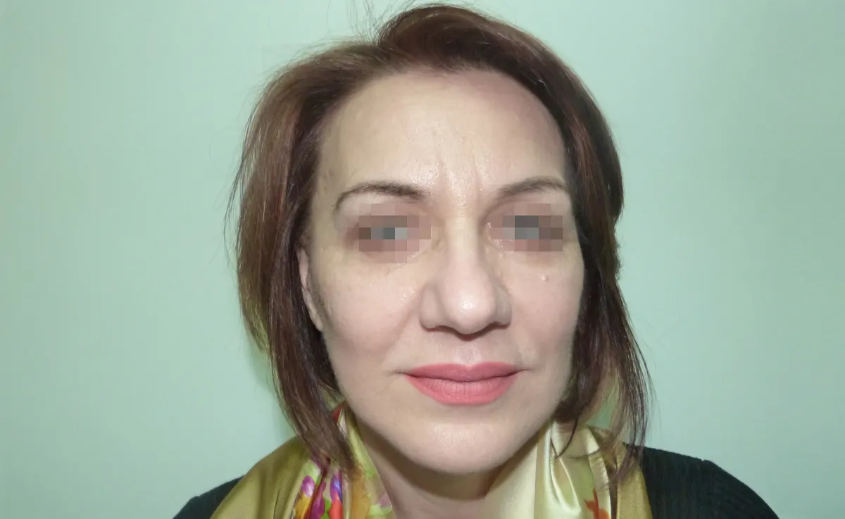 După