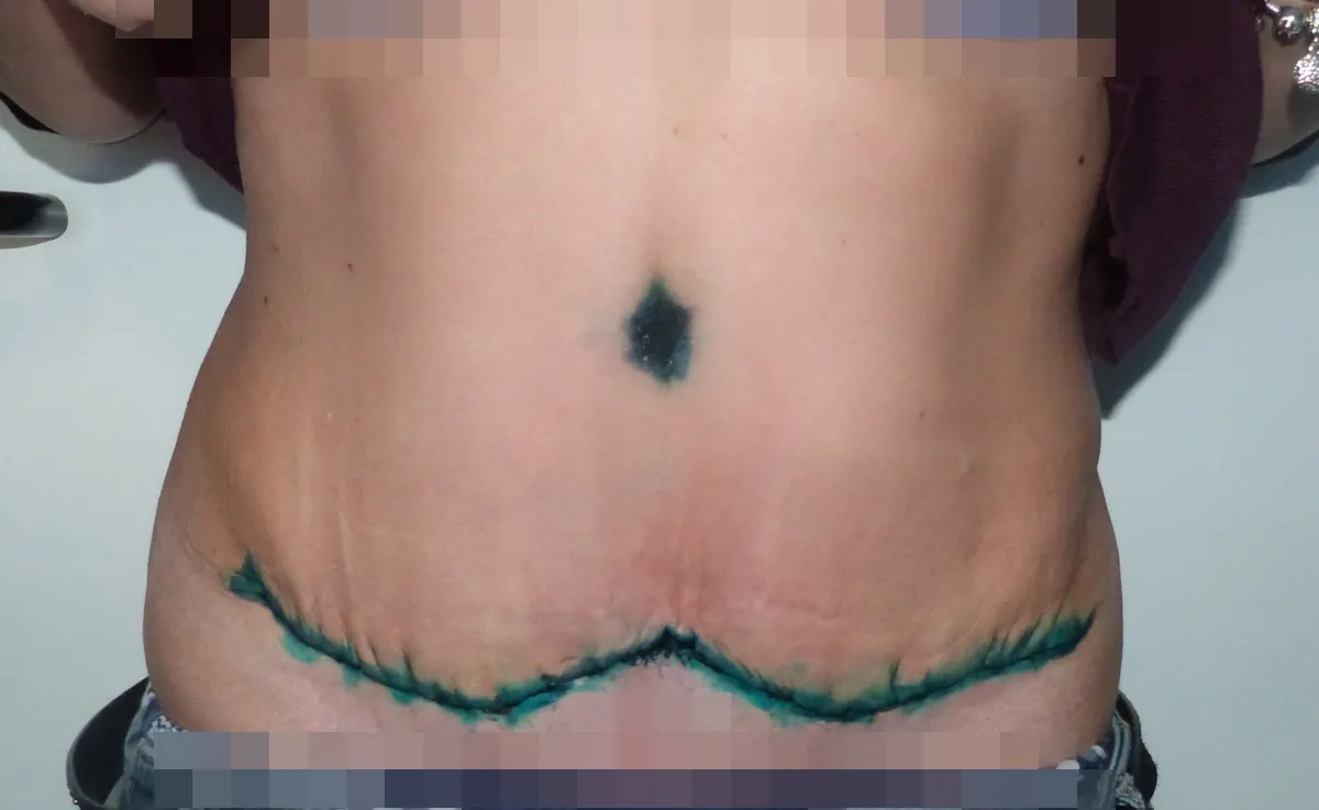 After
