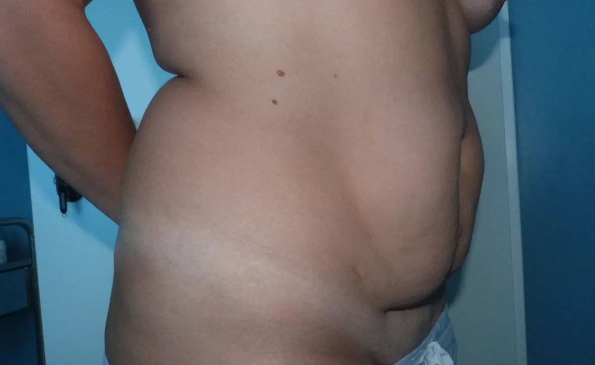 Before