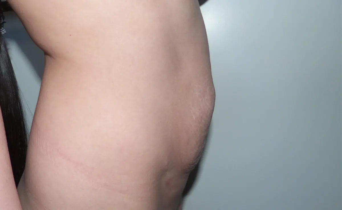 Before