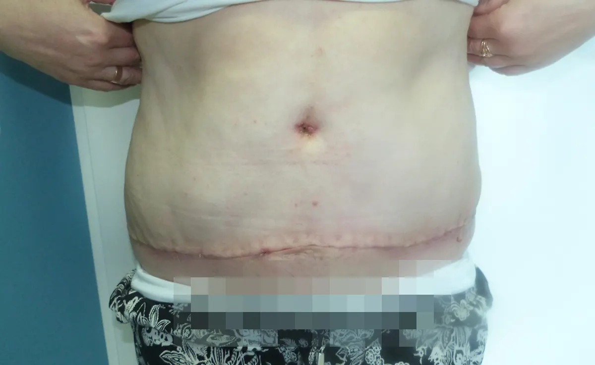 After