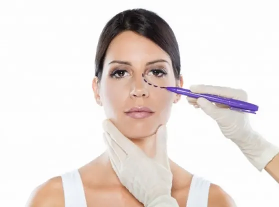 Blefaroplastie